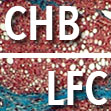 Chronic Hepatitis B Liver Fibrosis Calculator